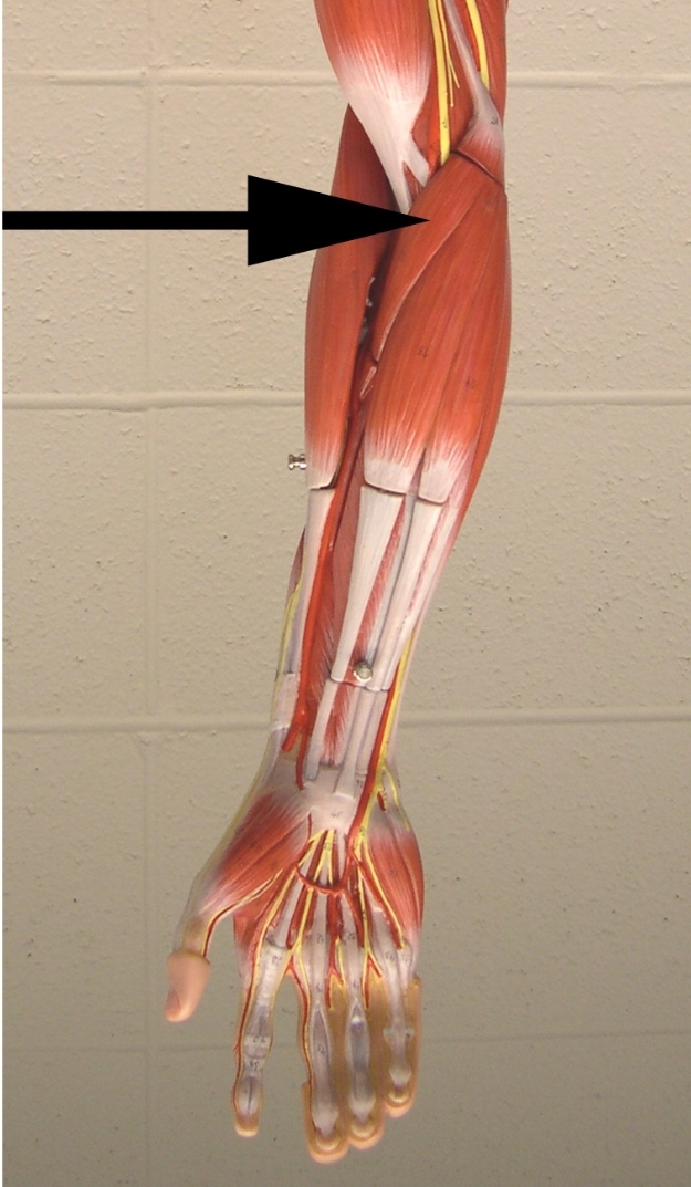 <p>What is one action of the muscle indicated by the arrow?</p><p>View: anterior side of the antebrachial region</p>