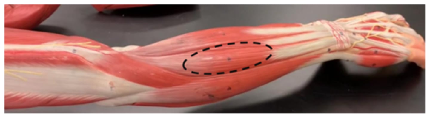 <p>next to extensor digitorum muscle (pack 2)</p>