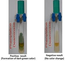 <p>Describe the test for phenylaline deamination, including<br>-  what deanimation is</p><ul><li><p>what kind of substance the broth is</p></li><li><p>the process</p></li><li><p>positive results</p></li><li><p>negative results</p></li></ul><p></p>