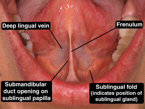 <p>Opens into the submandibular duct connecting to the sublingual fold (near canines)</p><ul><li><p>one major duct and several small ducts open in a line along the sublingual fold </p></li></ul><p></p>
