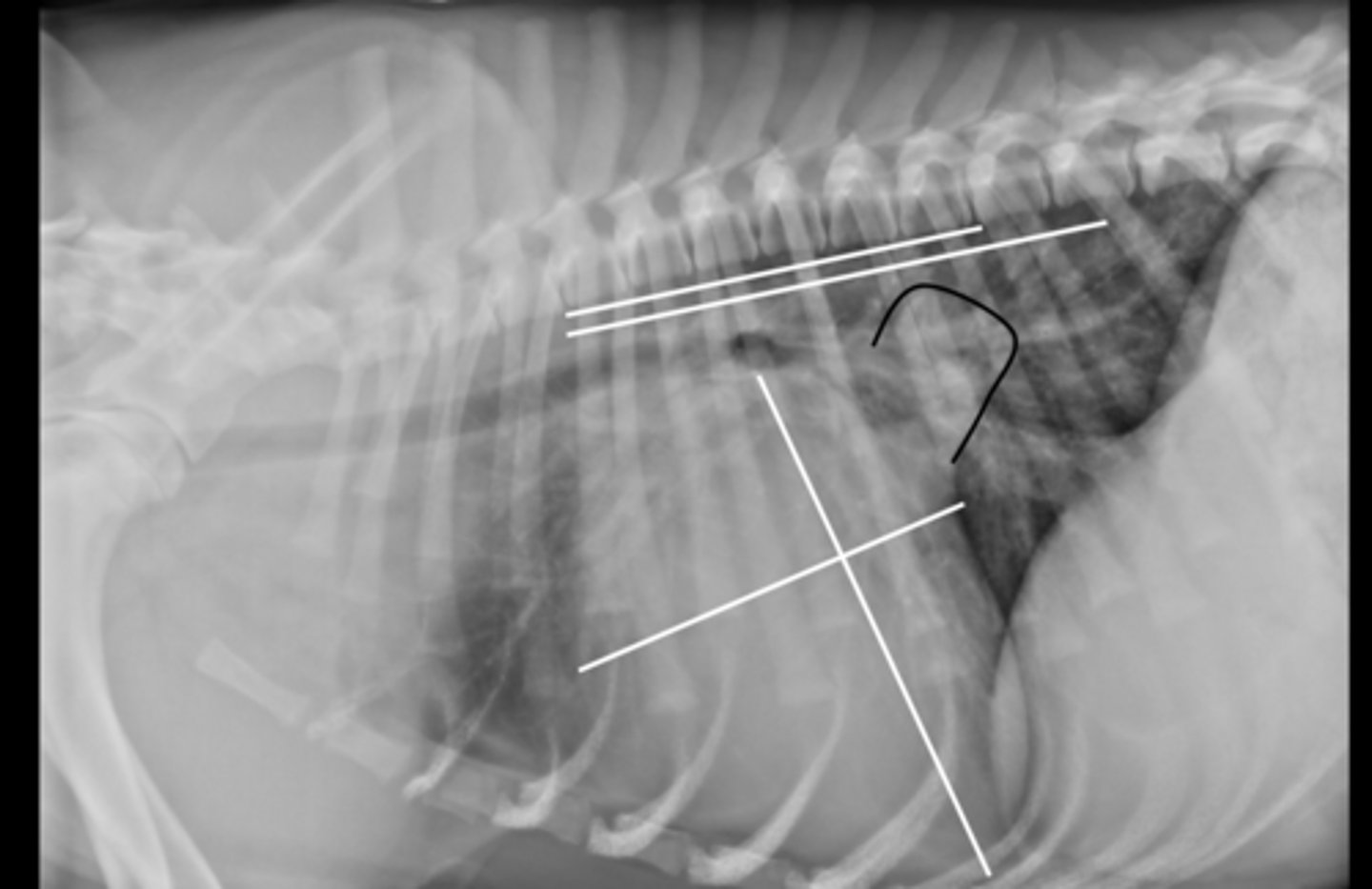 <p>Given the radiograph which structures are enlarged?</p>