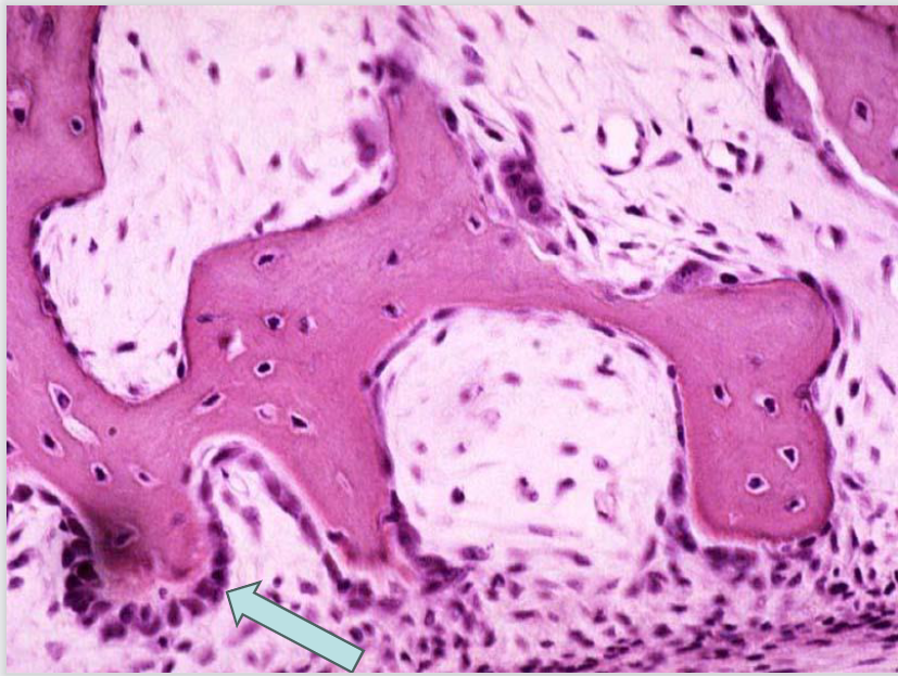 <p><em>de botcellen: osteoblast</em></p>
