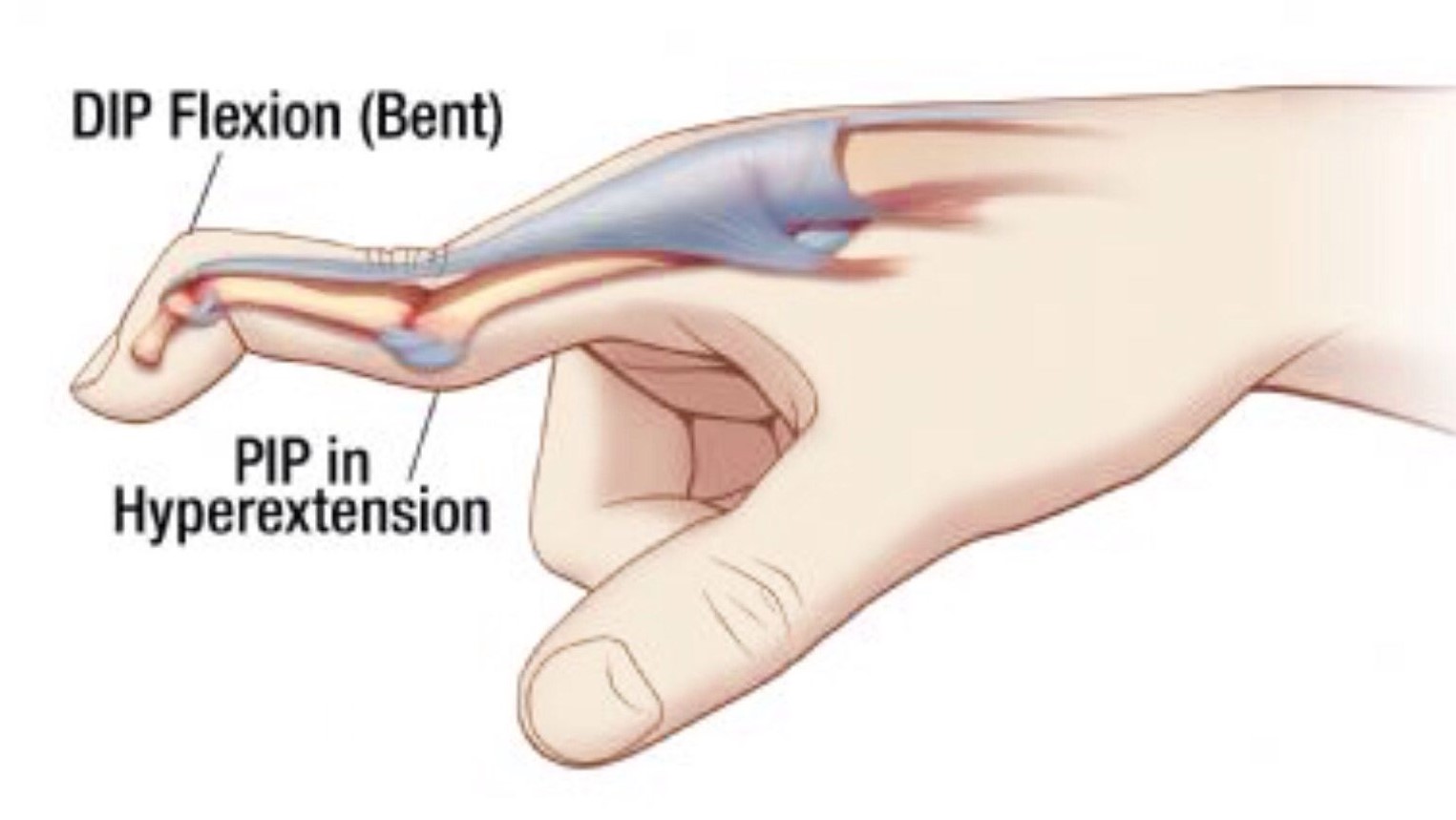 <p>swan neck </p>