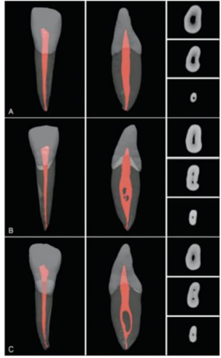 <p>lateral</p>