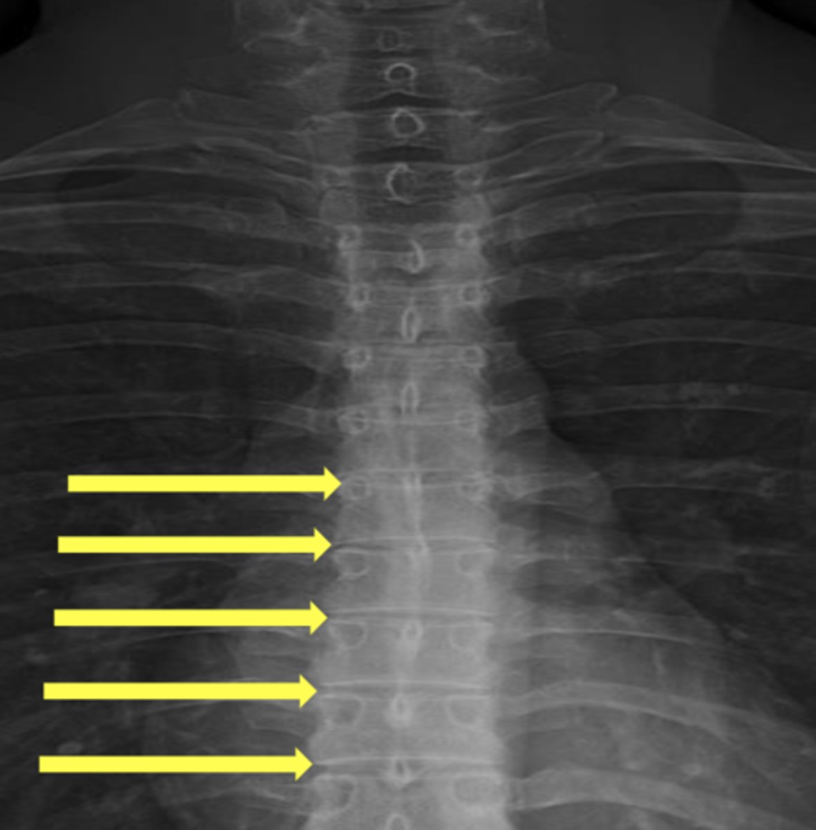 <p>What are the yellow arrows pointing to?</p>