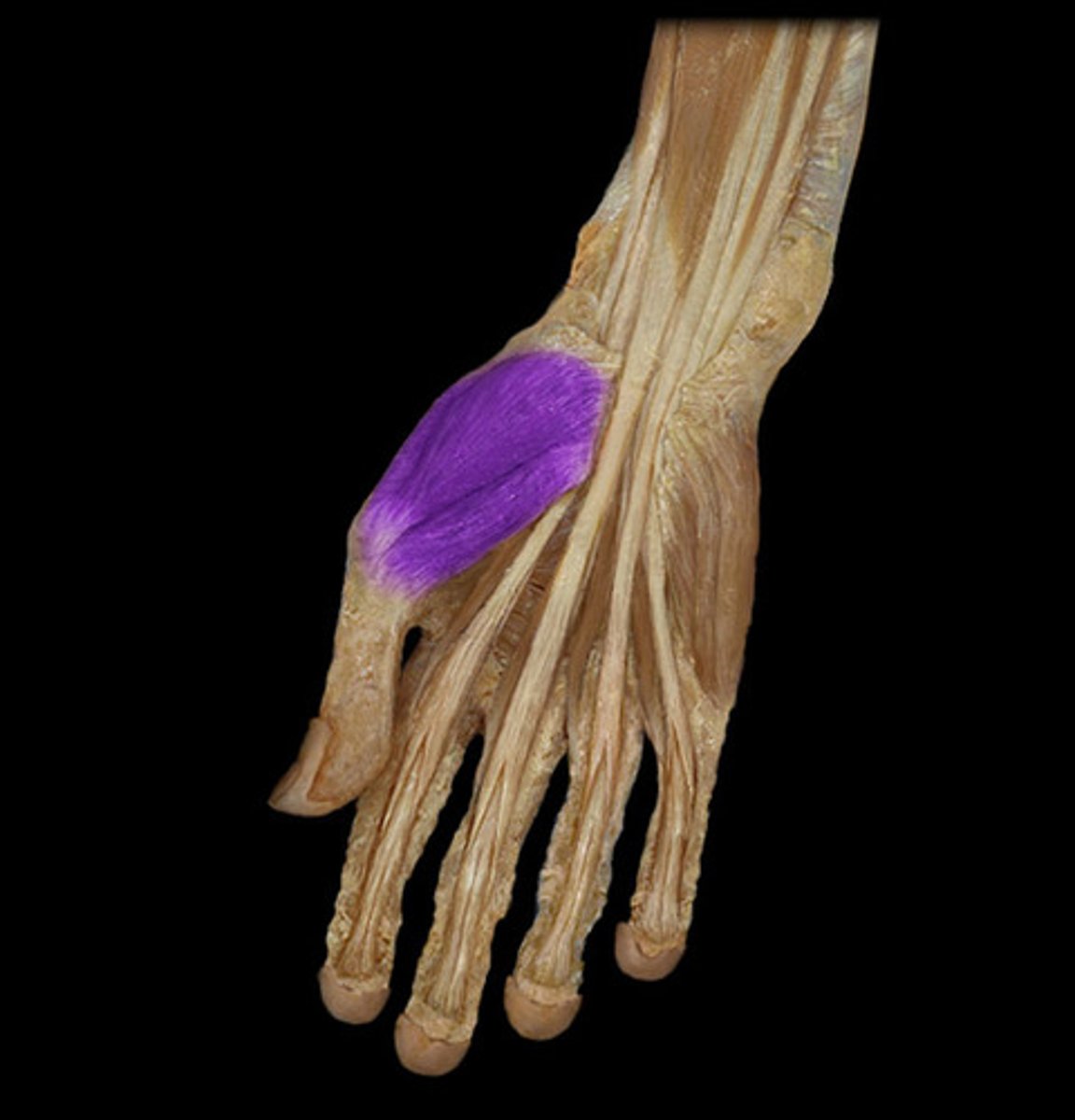 <p>Ball of thumb; includes flexor, abductor, and opponens muscles</p>