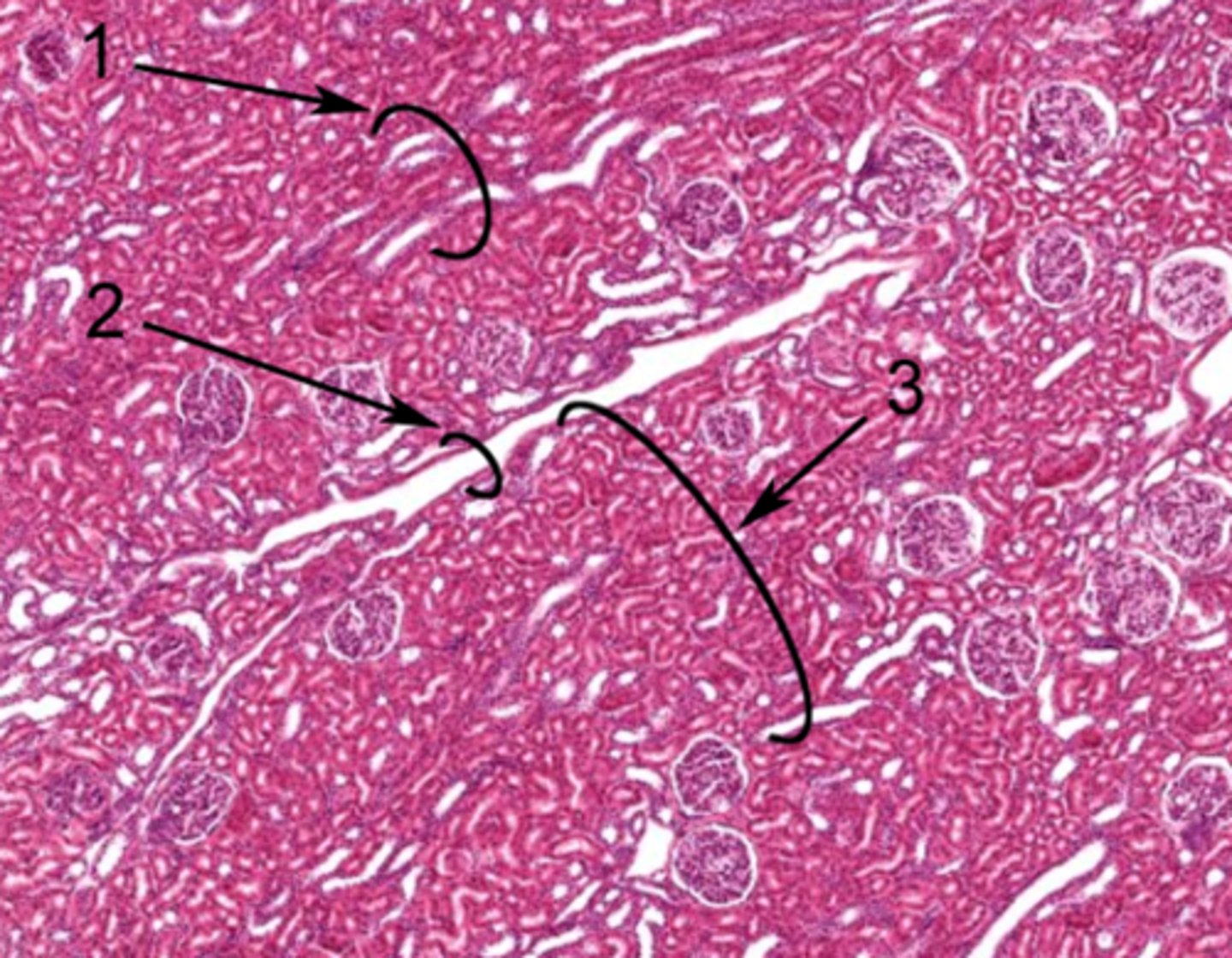 <p>Identify the structure in the cortex of the kidney at 2</p>