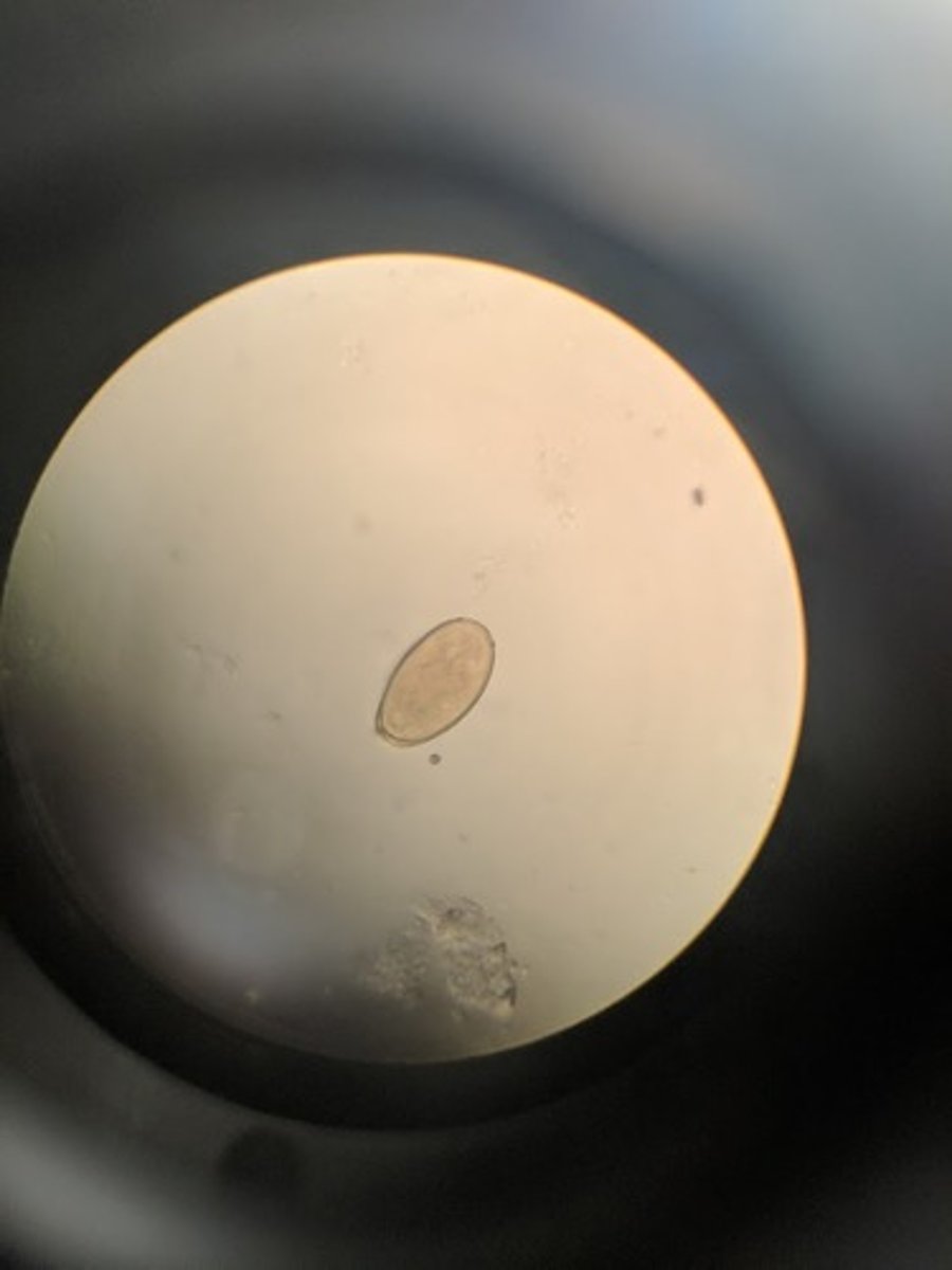 <p>Lung fluke</p><p>- oval ova, have an operculum (lid)</p><p>- golden in color</p><p>-shell has unevne thickness</p><p>-snails and crayfish are intermediate host</p><p>man is definitive host</p>