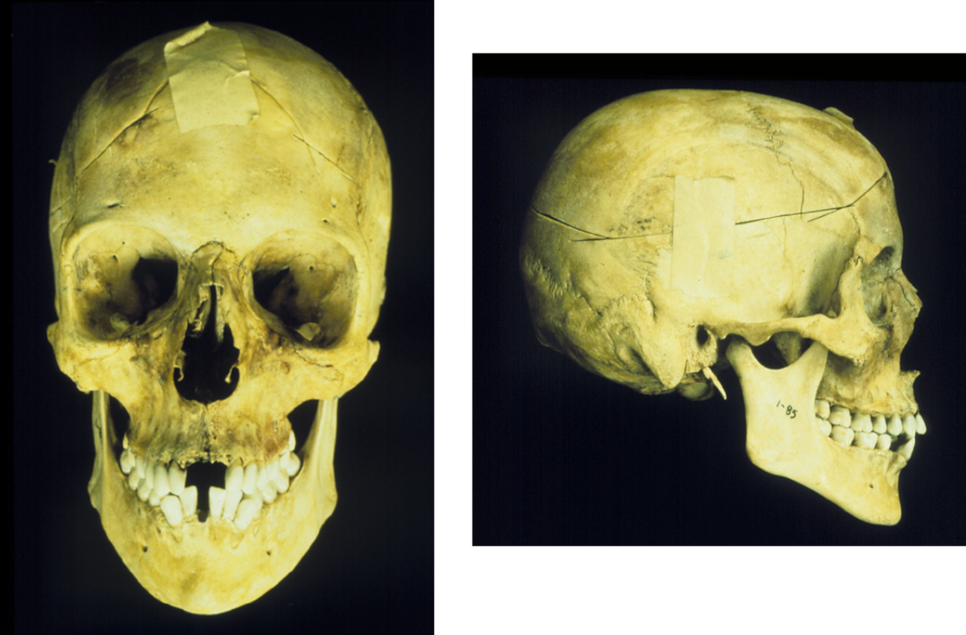 <p><span>What is the ancestry of this skull? </span></p>