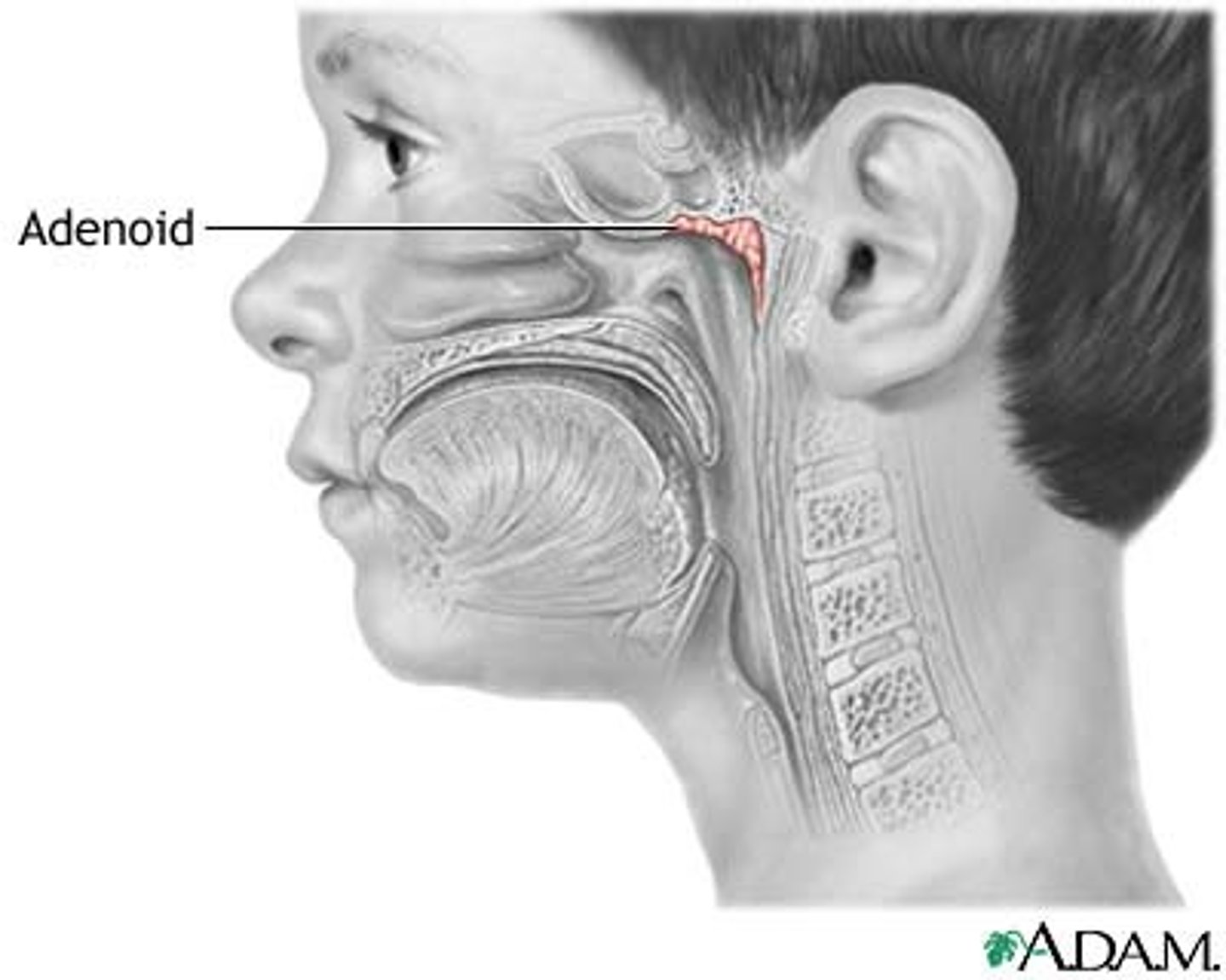 <p>Pharyngeal (adenoids)</p>