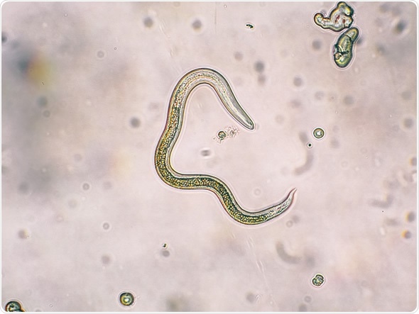 <p>Round worm adult</p><p>Dogs, cats, humans</p>
