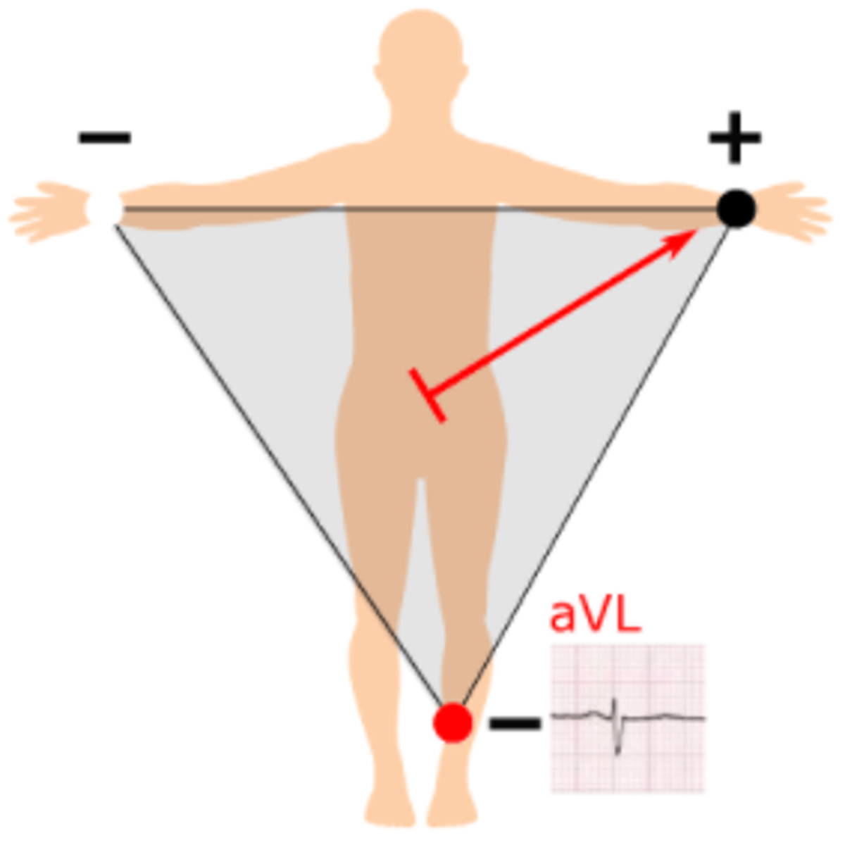 <p>From halfway between the right arm and left leg to the left arm, with the positive electrode being at the left arm at -30°</p>