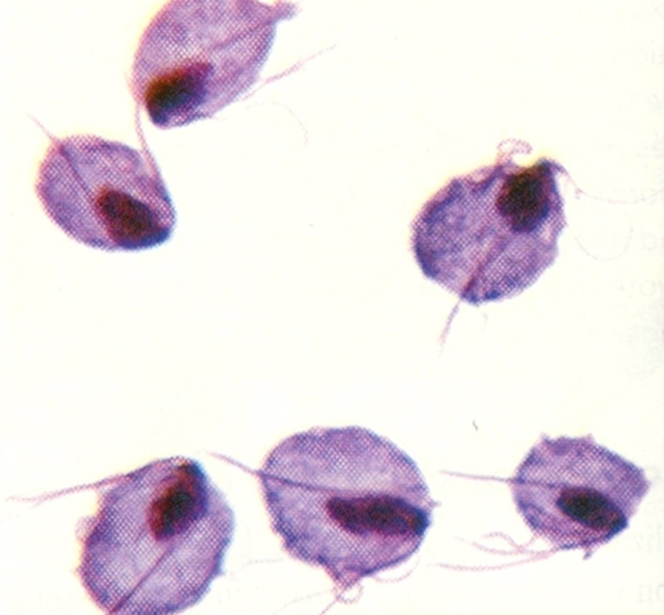 <p>= a drop of normal saline is added to a smear of vaginal secretions<br>+ test: large, round or slightly oval organism with flagella that are usually motile</p>