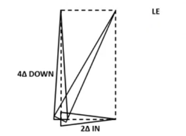 <p>another compound prism:</p><p>R +0.50 DS </p><p>L +0.27 /-0.25 × 90   2 base IN  4 base DOWN </p>