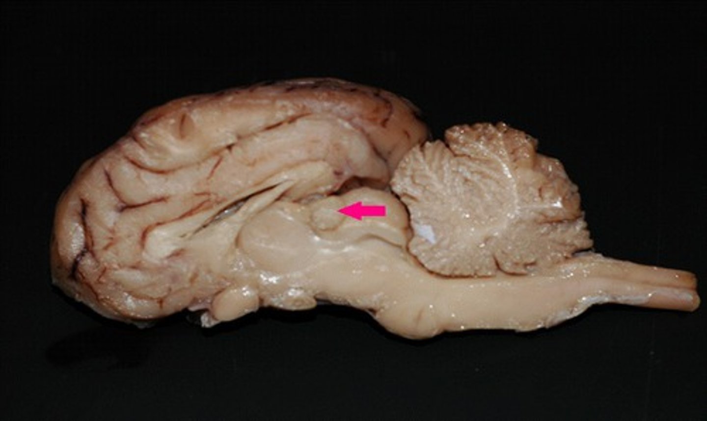 <p>Identify the structure.</p>