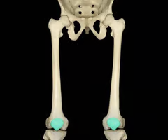 <p>sesamoid (a type of short) bone</p>