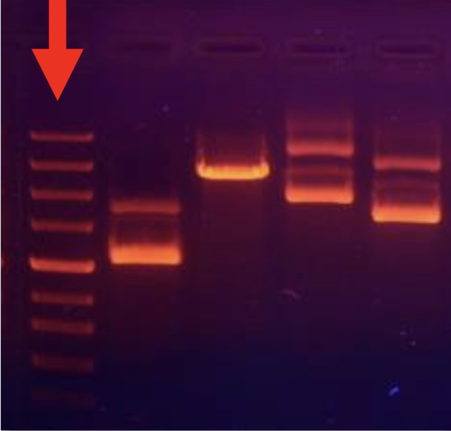 <p>this is a _______, the electrical separation of DNA on a gel</p>