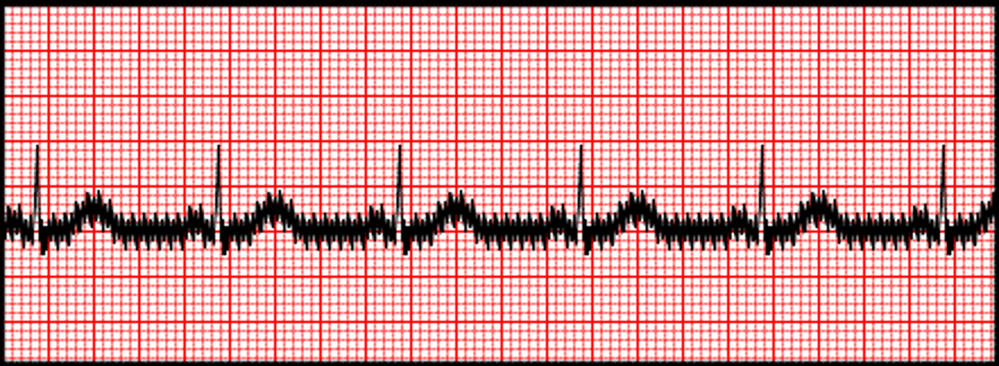 <p>Electrical interference</p>