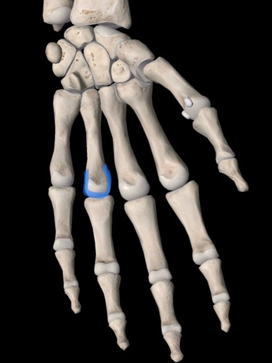 <p>bone</p>