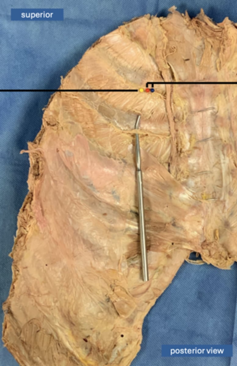 <p>vein</p>