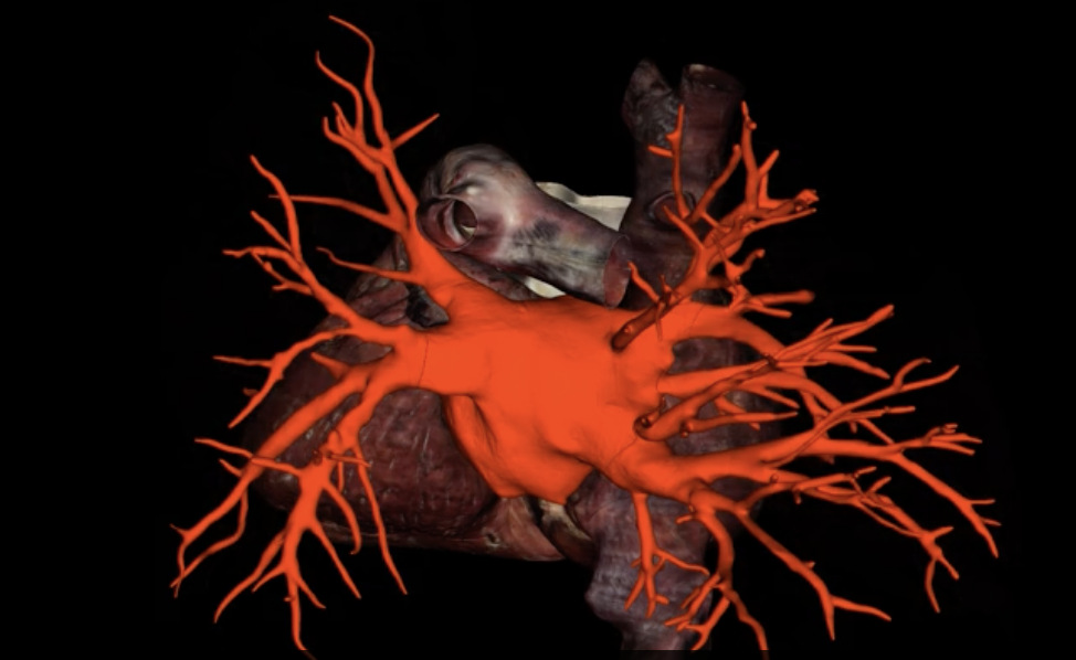 <p>What is highlighted in red?</p>