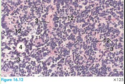 <p>Pineal gland contains pinealocytes (12), astrocytes (3)*</p><p>Pinealocytes are responsible for secreting melatonin</p><p>Pinealocytes are arranged like cords, follicles</p><p></p><p>Human pineal gland contains characteristic, extracellular concretions called corpora arenacea (brain sand)</p>