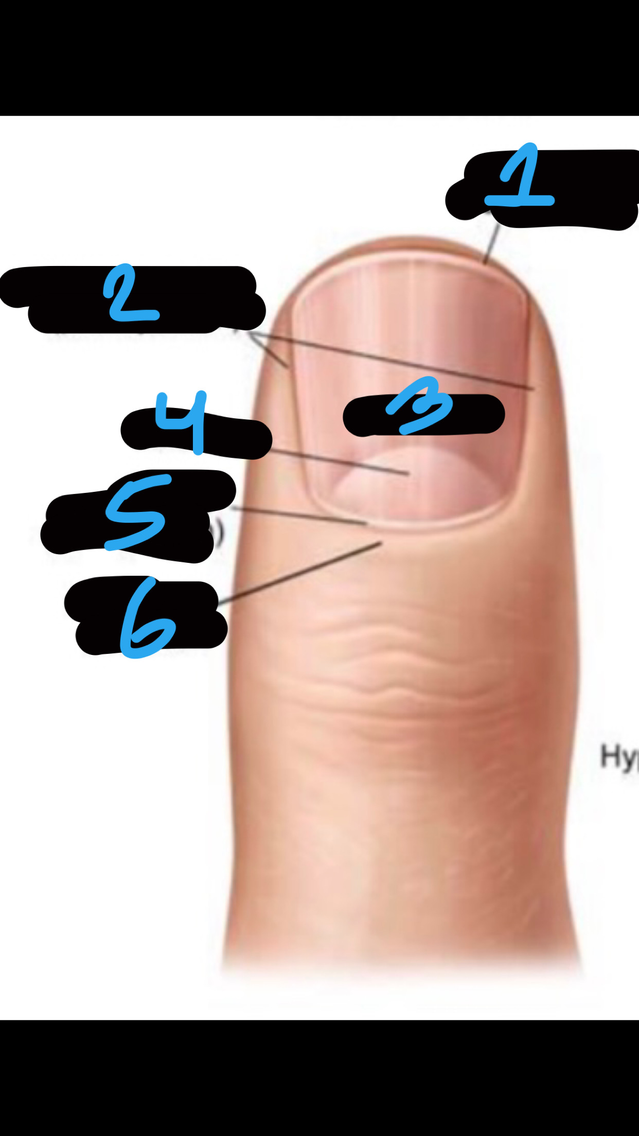 <p>number 5 </p>