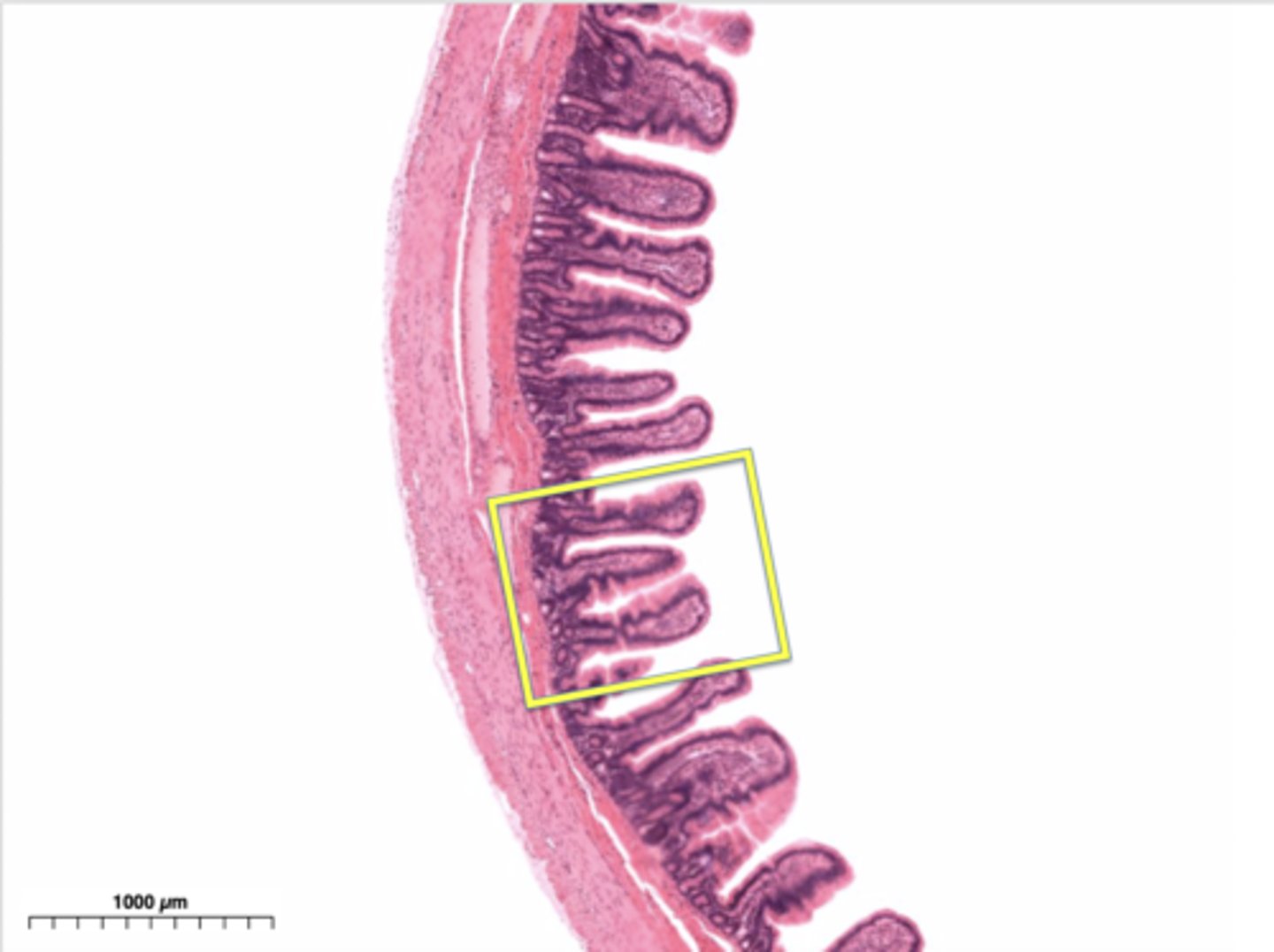 <p>Tiny finger-shaped structures that cover the inner surface of the small intestine and provide a large surface area through which digested food is absorbed</p>