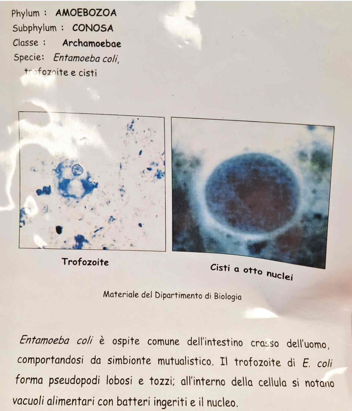 <p><em>Entamoeba coli</em></p>