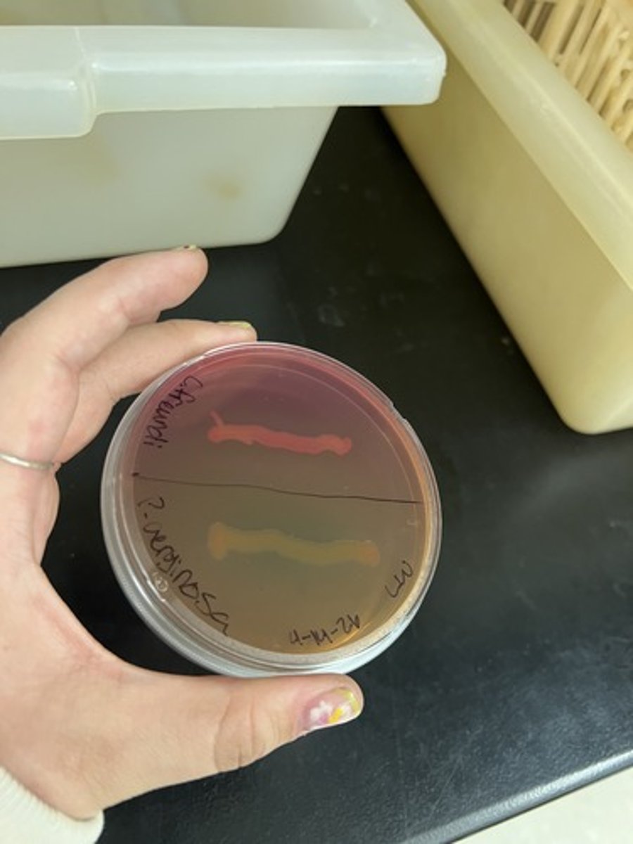 <p><strong>Selective </strong>for gram (-) sp.</p><p><strong>Differential </strong>for lactose fermentation</p><p>Fermentation (+): Pink Colonies</p><p>Beige agar (-): Peptone Utilization</p><p>EX: <em>Escherichia coli</em></p>
