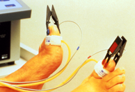 <p>Cuff on toe or other digit that takes small pressures (1.9 or 2.5) alongside use of <strong>PPG </strong>transducer to display<strong> SYSTOLIC </strong>blood flow</p>