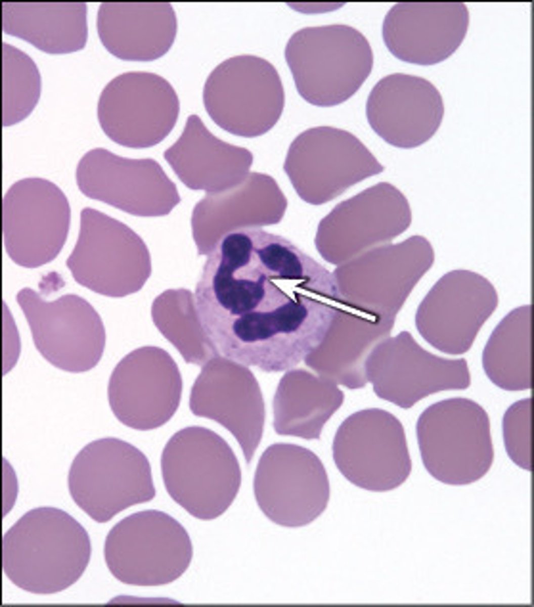 <p>little branch on the multi-lobe granules</p><p>----------------------------------</p><p>an expression of an x chromosome cell in which more than one is present</p>