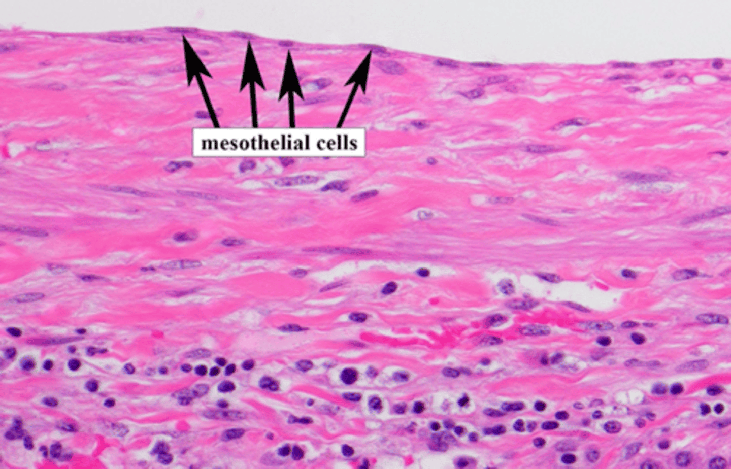 <p>The outermost surface (capsule) of the liver is covered by mesothelial cells that arise from the peritoneum.</p>