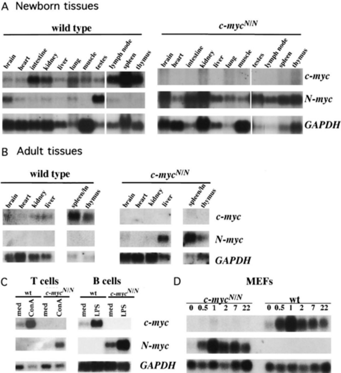 <p>Positive N-myc (MYCN) levels.</p>