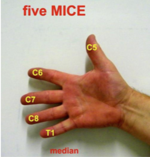 <p>C5-T1</p>