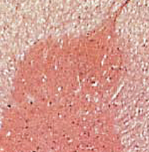 <p><span>ceiling of gray horns</span></p>