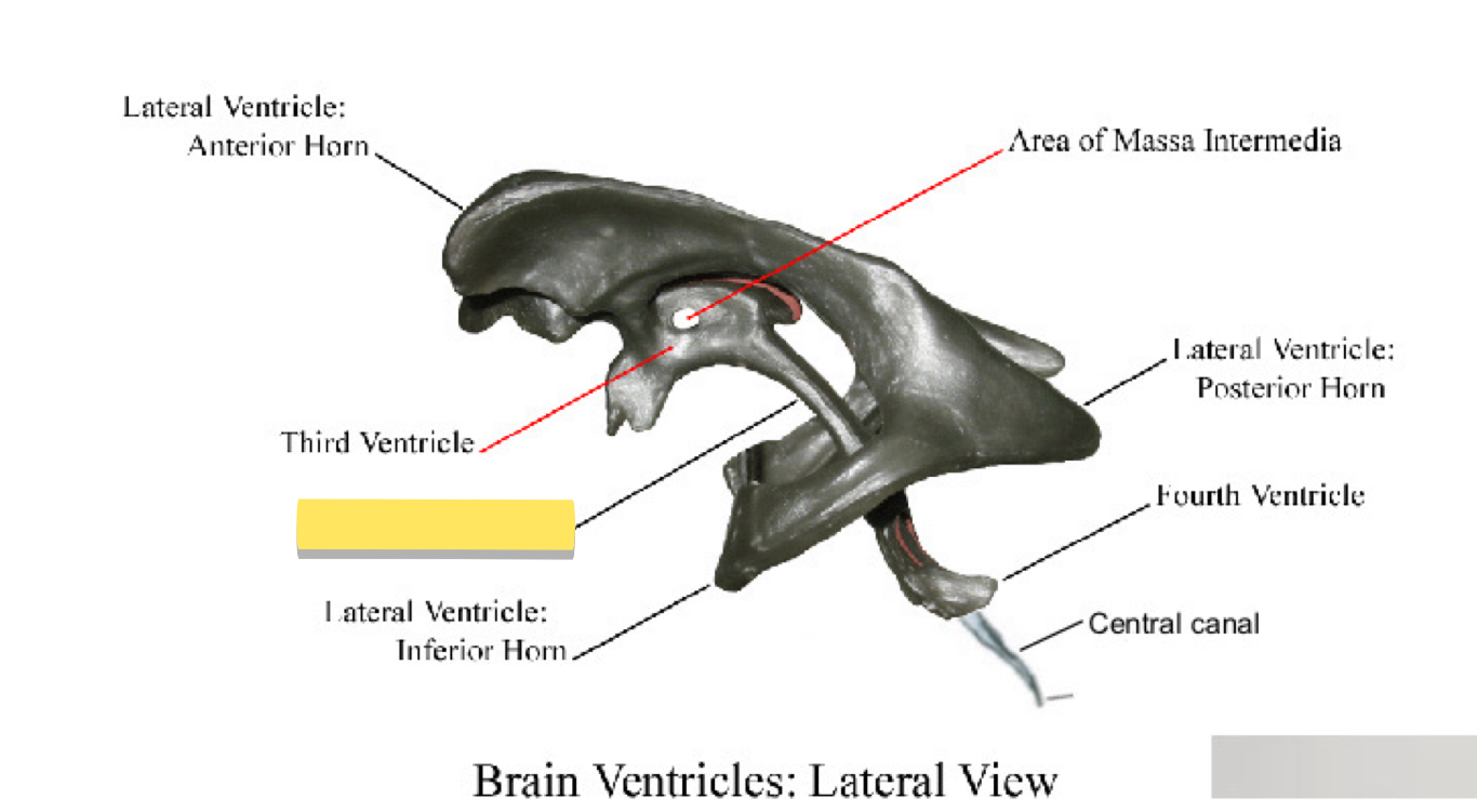 <p>Name this brain ventricle </p>