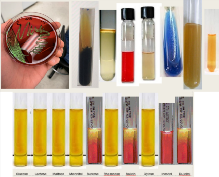 <p>What is responsible for the characteristic butt reaction in the TSI result of this organism?</p>
