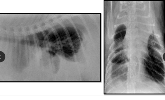 <p>Pleural Effusion Clinical Signs</p>