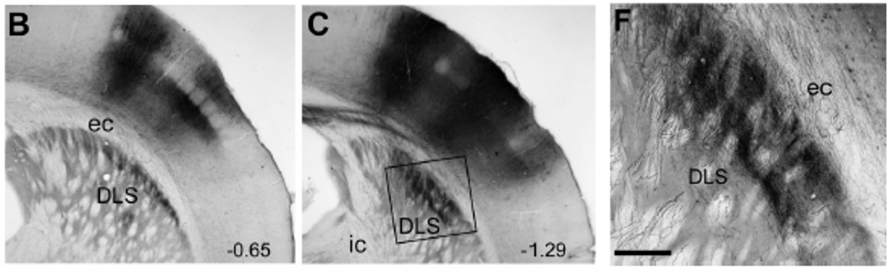 <p>rat SI barrel cortex projects to the dorsolateral striatum (DLS)</p>