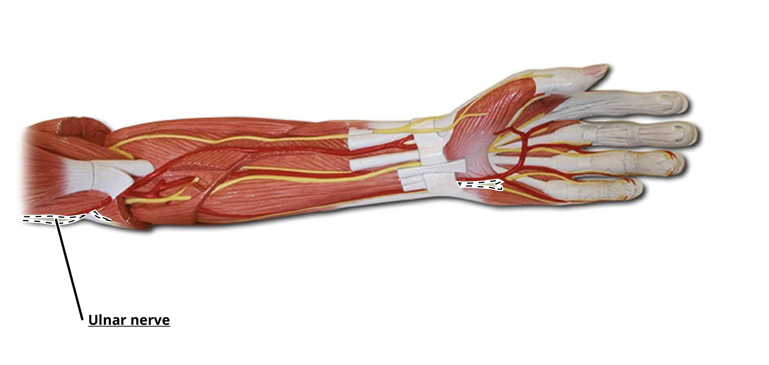 <p>Ulnar Nerve </p>