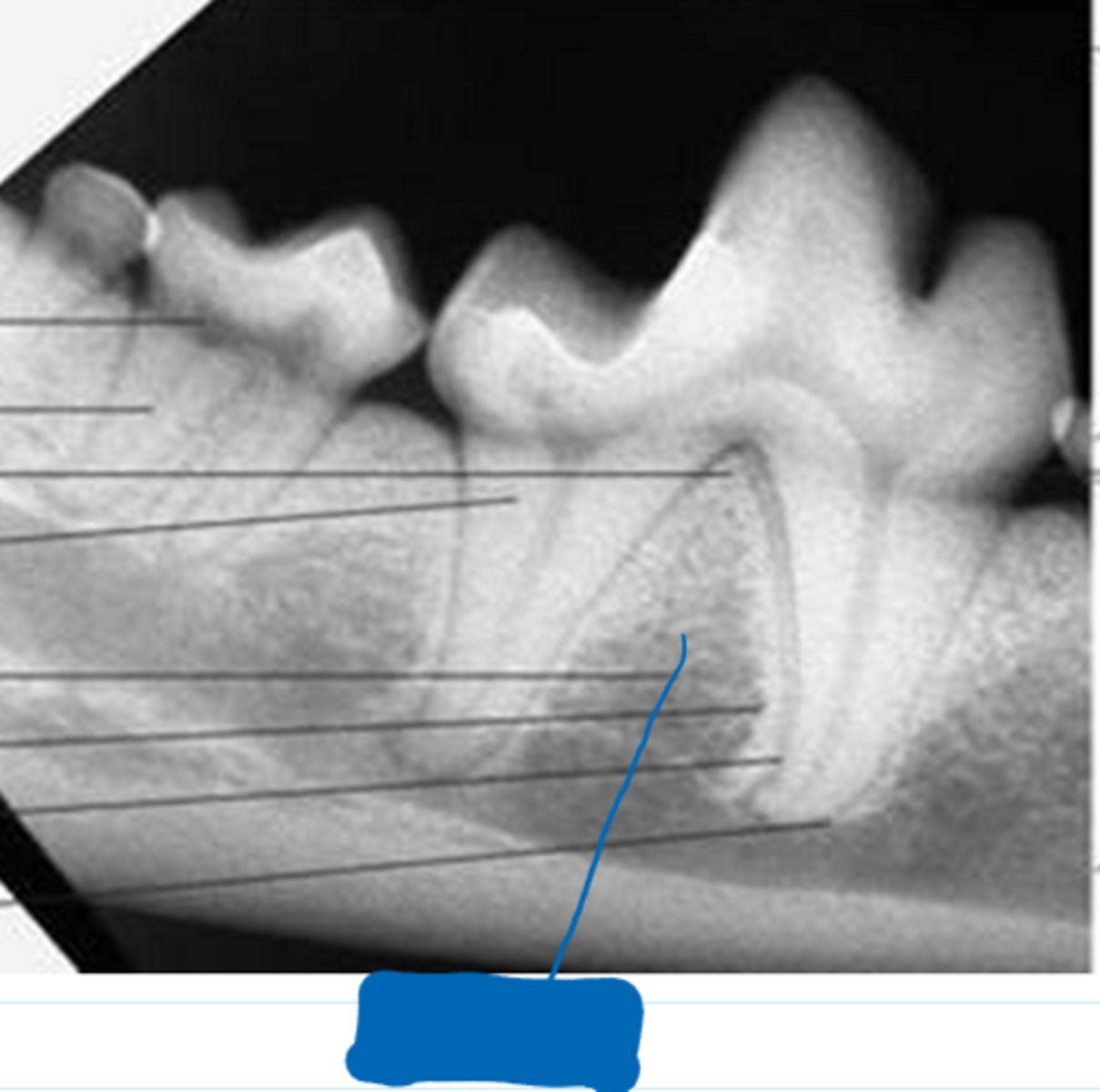 <p>What is the blue box in the image pointing to?</p>