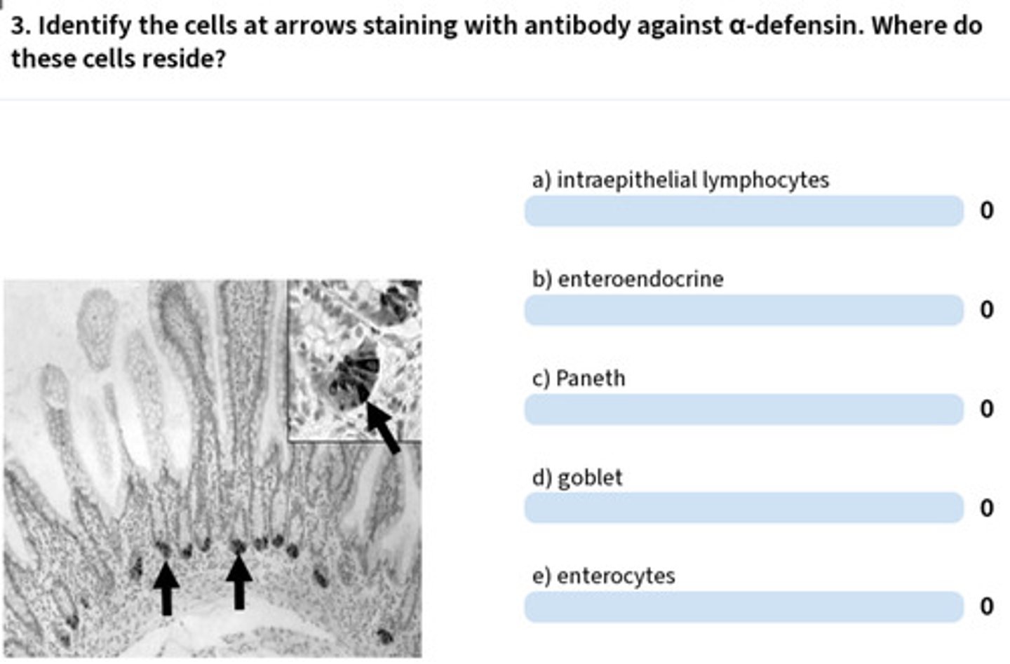 <p>paneth cells</p>