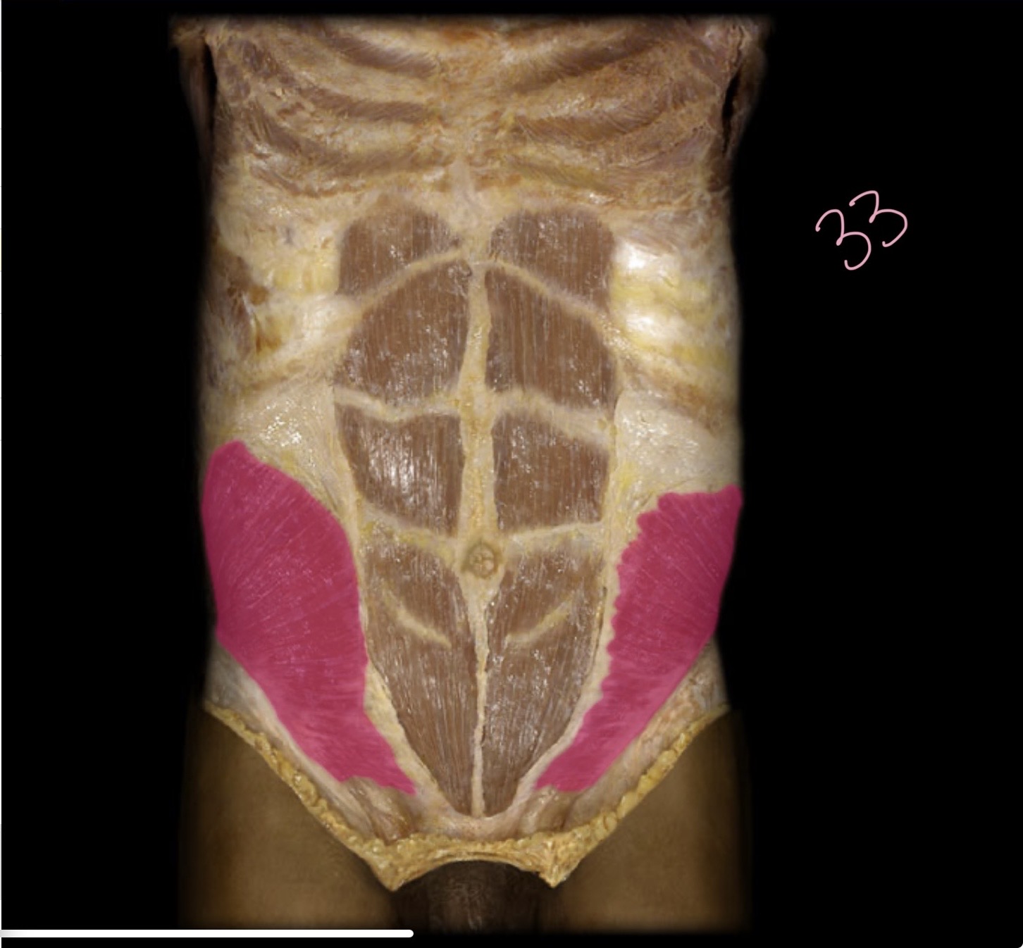 <p>Internal abdominal oblique</p>
