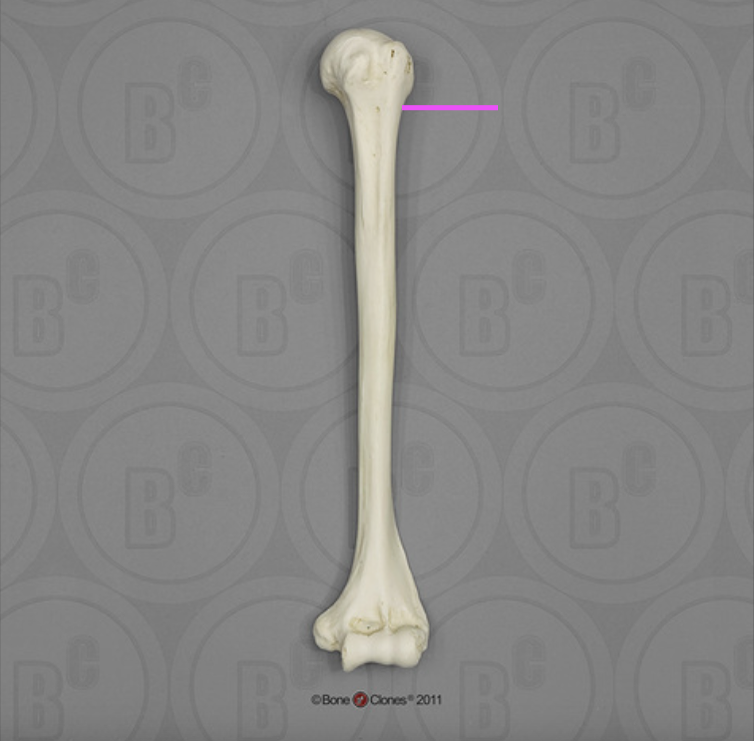 <p>What part of the humerus is this?</p>