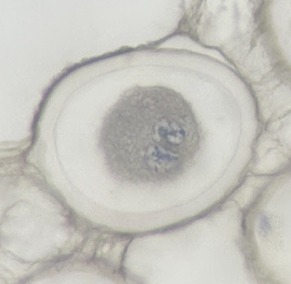 <p>stage of fertilization</p>