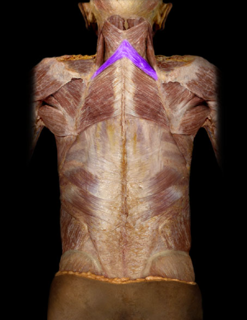 <ul><li><p>Action: Retraction (adduction) of scapula, Elevation of scapula</p></li><li><p>Origin: Spinous processes of C7-T1 vertebrae</p></li><li><p>Insertion: Scapula (medial border)</p></li><li><p>Innervation: Dorsal scapular nerve</p></li></ul><p></p>