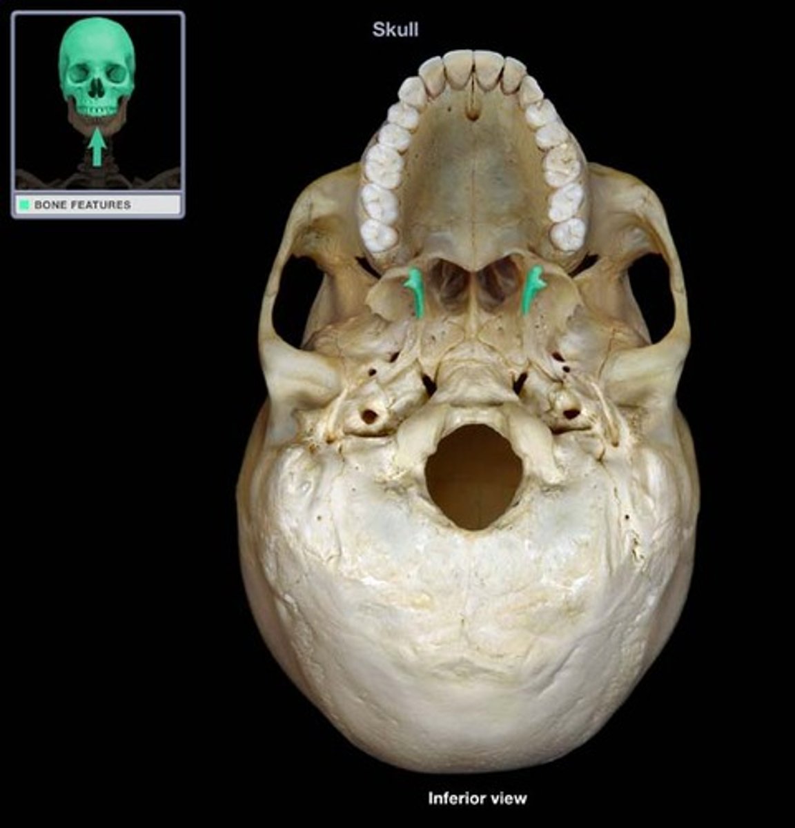 <p>sharp process that medially and inferiorly projects from the sphenoid</p>