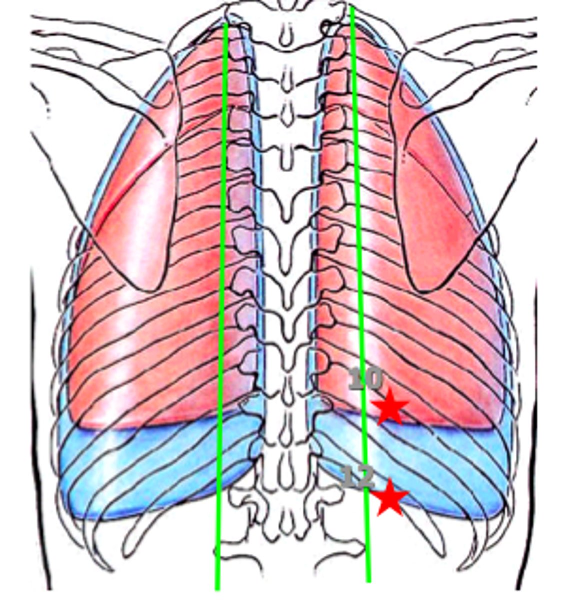 <p>where costal and mediastinal surfaces meet posteriorly</p>
