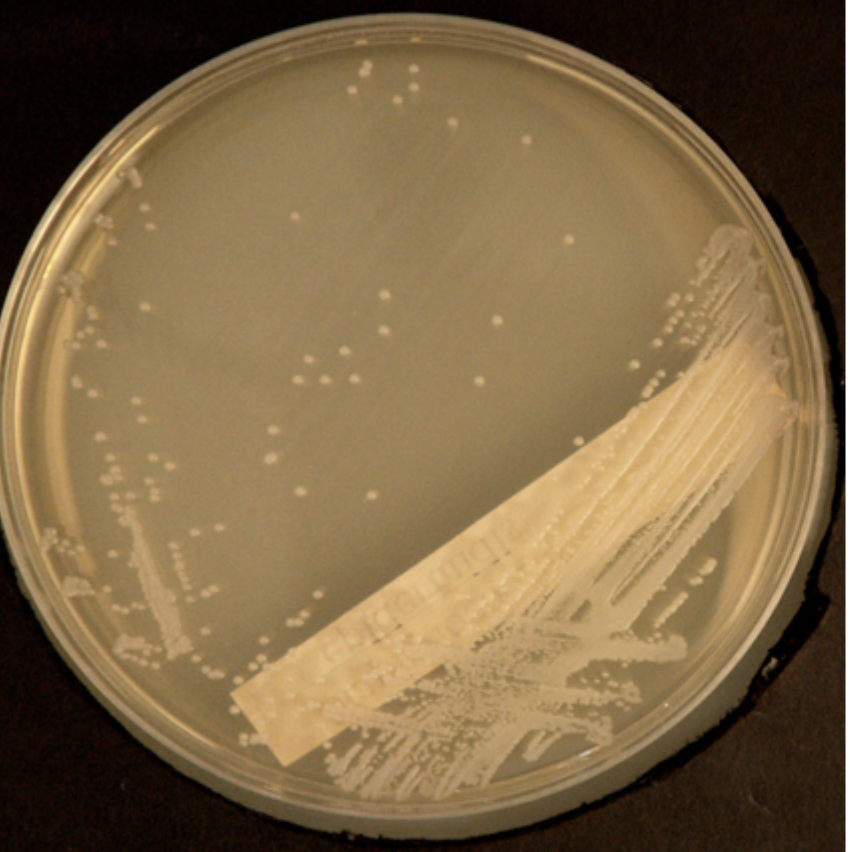 <p>White/off-white</p><p>Opaque</p><p>Convex</p><p>Round colonies with sharp, clear edges</p><p>Coagulase negative</p><p>Catalase positive</p><p>Gram +</p>